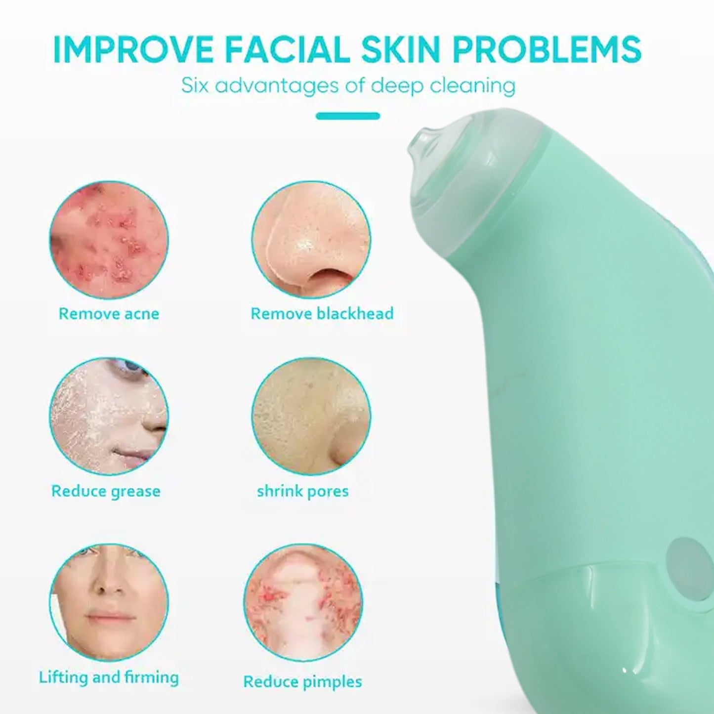 Blackhead Remover Vacuum Cleaner – Portable Facial Pore Cleaner & Acne Remover Tool
